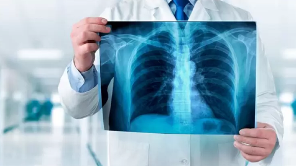 20 مورد خواندنی از اشعه ایکس