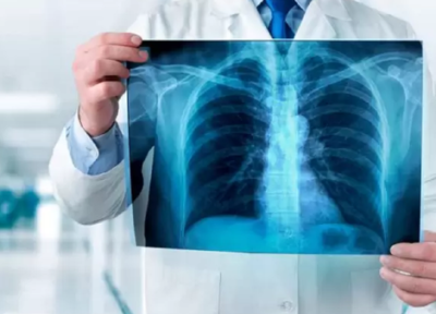 20 مورد خواندنی از اشعه ایکس
